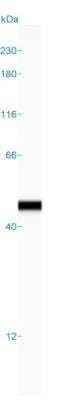 Simple Western Analysis of alpha-Smooth Muscle Actin in Aorta Lysate
