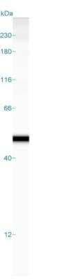 Detection of alpha-Smooth Muscle Actin in Uterus Lysate by Simple Western