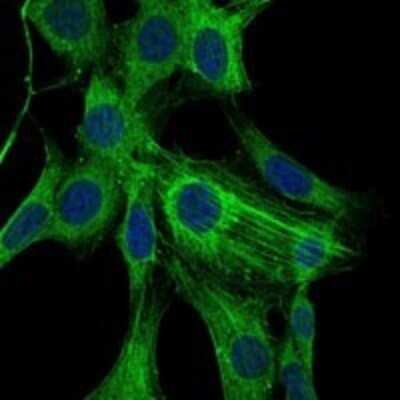 Immunocytochemistry/ Immunofluorescence: alpha-Smooth Muscle Actin Antibody (1H8) - BSA Free [NBP2-37641]