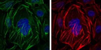 Immunocytochemistry/ Immunofluorescence: alpha-Smooth Muscle Actin Antibody (4A4) - BSA Free [NBP2-22120]