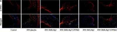 Immunohistochemistry: alpha-Smooth Muscle Actin Antibody (4A4) - BSA Free [NBP2-22120]