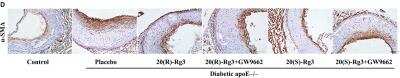 Immunohistochemistry: alpha-Smooth Muscle Actin Antibody (4A4) - BSA Free [NBP2-22120]
