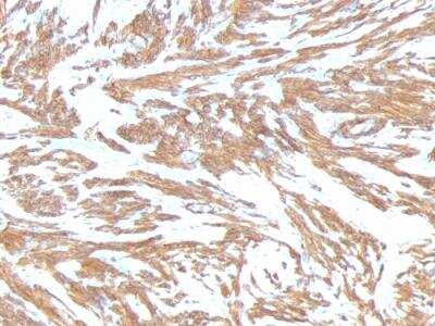Immunohistochemistry-Paraffin: alpha-Smooth Muscle Actin Antibody (ACTA2/791) - IHC-Prediluted [NBP2-48132]