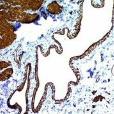 Immunohistochemistry-Paraffin: alpha-Smooth Muscle Actin Antibody (ACTA2/791) - IHC-Prediluted [NBP2-48132]