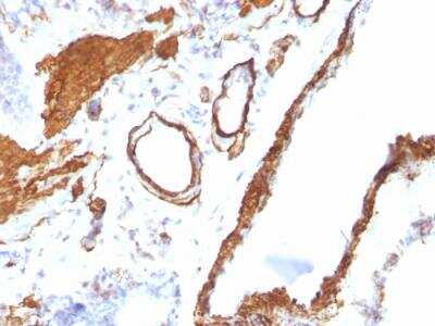 Immunohistochemistry-Paraffin: alpha-Smooth Muscle Actin Antibody (ACTA2/791) - IHC-Prediluted [NBP2-48132]