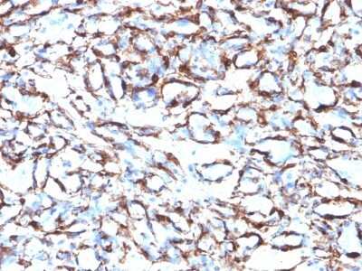 Immunohistochemistry-Paraffin: alpha-Smooth Muscle Actin Antibody (ACTA2/791) [NBP2-44463]