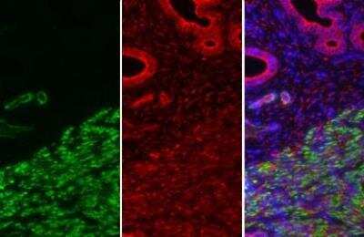 Immunohistochemistry-Paraffin: alpha-Smooth Muscle Actin Antibody [NBP1-30894]