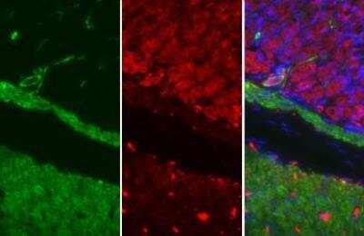 Immunohistochemistry-Paraffin: alpha-Smooth Muscle Actin Antibody [NBP1-30894]