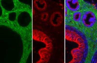 Immunohistochemistry-Paraffin: alpha-Smooth Muscle Actin Antibody [NBP1-30894]