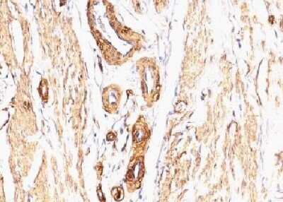 Immunohistochemistry-Paraffin: alpha-Smooth Muscle Actin Antibody (SPM332) - Azide and BSA Free [NBP2-34760]