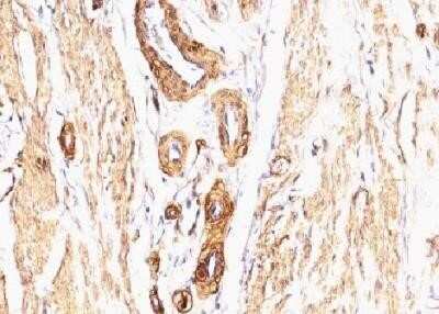 Immunohistochemistry-Paraffin: alpha-Smooth Muscle Actin Antibody (SPM332) [NBP2-32808]