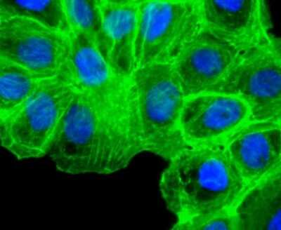 Immunocytochemistry/ Immunofluorescence: alpha-Smooth Muscle Actin Antibody (SY02-64) [NBP2-67440]
