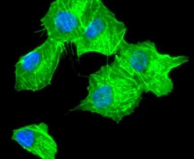 Immunocytochemistry/ Immunofluorescence: alpha-Smooth Muscle Actin Antibody (SY02-64) [NBP2-67440]