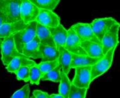 Immunocytochemistry/ Immunofluorescence: alpha-Smooth Muscle Actin Antibody (SY02-64) [NBP2-67440]