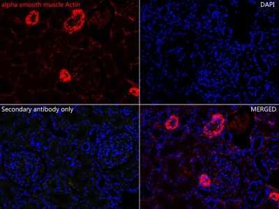 Immunohistochemistry-Paraffin: alpha-Smooth Muscle Actin Antibody (SY02-64) [NBP2-67440]