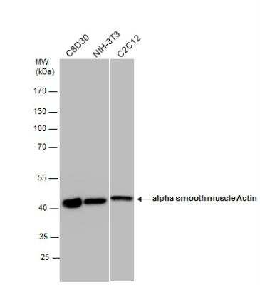 Western Blot: alpha-Smooth Muscle Actin Antibody [NBP1-30894]