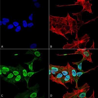 Immunocytochemistry/ Immunofluorescence: alpha-Synuclein Antibody (3C11) [NBP3-18258]