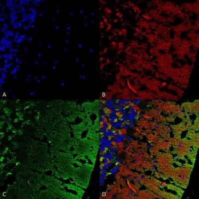 Immunohistochemistry: alpha-Synuclein Antibody (3C11) [NBP3-18258]