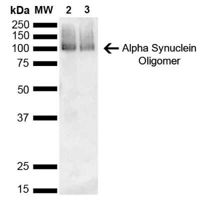 Western Blot: alpha-Synuclein Antibody (3C11) [NBP3-18258]