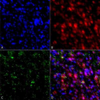 Immunocytochemistry/ Immunofluorescence: alpha-Synuclein Antibody (4F1) [NBP3-18259]