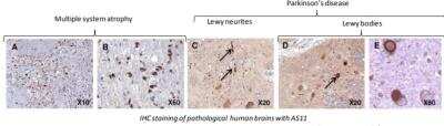 Immunohistochemistry: alpha-Synuclein Antibody (AS11) [DDX0910P-100]