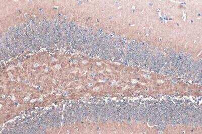 Immunohistochemistry-Paraffin: alpha-Synuclein Antibody [NBP2-15365]