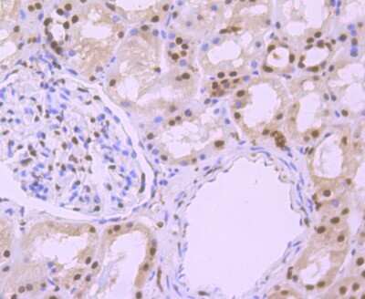 Immunohistochemistry-Paraffin: alpha-Synuclein Antibody (JB22-44) [NBP2-75409]