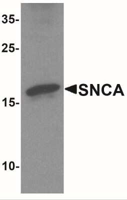 Western Blot: alpha-Synuclein AntibodyBSA Free [NBP2-41288]