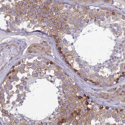 Immunohistochemistry-Paraffin: alpha-Taxilin Antibody [NBP1-91662]