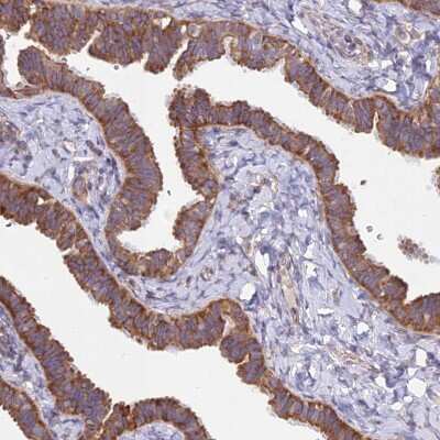 Immunohistochemistry-Paraffin: alpha-Taxilin Antibody [NBP1-91662]