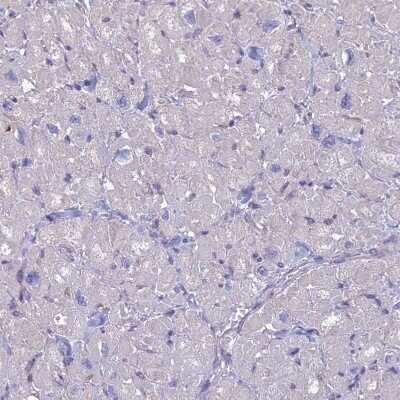 Immunohistochemistry-Paraffin: alpha-Taxilin Antibody [NBP1-91662]