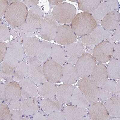 Immunohistochemistry-Paraffin: alpha-Taxilin Antibody [NBP1-91662]