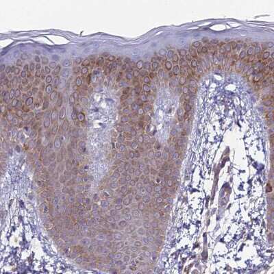 Immunohistochemistry-Paraffin: alpha-Taxilin Antibody [NBP1-91662]
