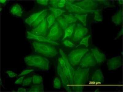Immunocytochemistry/ Immunofluorescence: alpha Tubulin 4a Antibody (2E11) [H00007277-M01]
