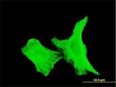 Immunocytochemistry/ Immunofluorescence: alpha Tubulin 4a Antibody (2E9) [H00007277-M06]
