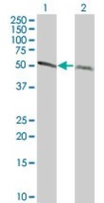Western Blot: alpha Tubulin 4a Antibody (2E9) [H00007277-M06]