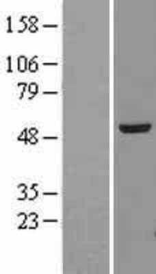 Western Blot: alpha Tubulin 4a Overexpression Lysate [NBL1-17433]
