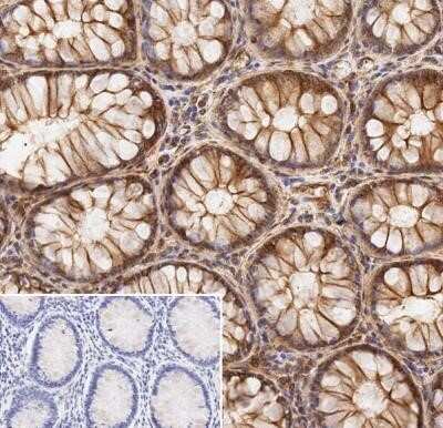 Immunohistochemistry: alpha Tubulin Antibody (DM1A) - Azide and BSA Free [NBP2-80570]