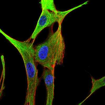 Immunocytochemistry/ Immunofluorescence: alpha Tubulin Antibody (DM1A) - BSA Free [NB100-690]