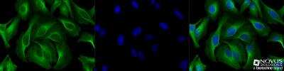 Immunocytochemistry/ Immunofluorescence: alpha Tubulin Antibody (DM1A) - BSA Free [NB100-690]