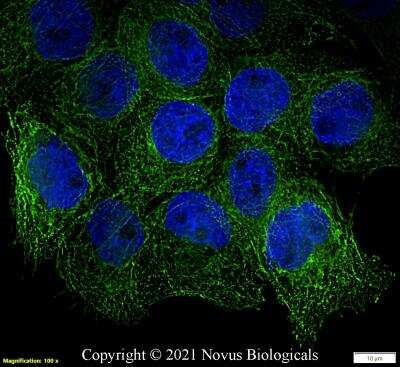 Immunocytochemistry/ Immunofluorescence: alpha Tubulin Antibody (DM1A) - BSA Free [NB100-690]