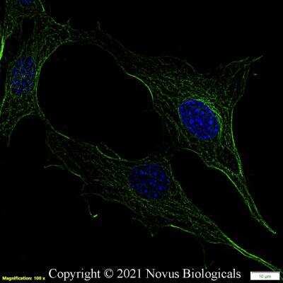 Immunocytochemistry/ Immunofluorescence: alpha Tubulin Antibody (DM1A) - BSA Free [NB100-690]