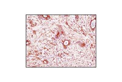 Immunohistochemistry: alpha Tubulin Antibody (DM1A) - BSA Free [NB100-690]