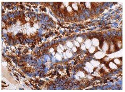 Immunohistochemistry: alpha Tubulin Antibody (DM1A) - BSA Free [NB100-690]