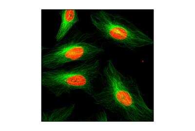 Immunomicroscopy: alpha Tubulin Antibody (DM1A) - BSA Free [NB100-690]
