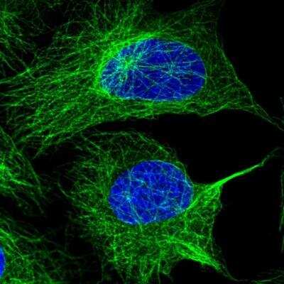 Immunocytochemistry/ Immunofluorescence: alpha Tubulin Antibody [NBP2-54708]