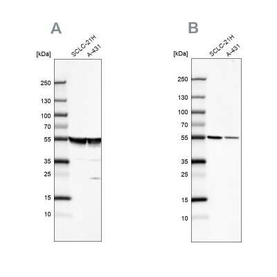 Western Blot: alpha Tubulin Antibody [NBP2-54687]