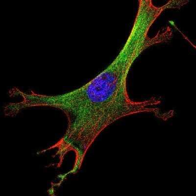 Immunocytochemistry/ Immunofluorescence: alpha Tubulin Antibody (YL1/2) - Azide and BSA Free [NBP2-80571]