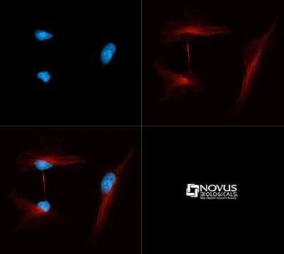 Immunocytochemistry/ Immunofluorescence: alpha Tubulin Antibody (YL1/2) - Azide and BSA Free [NBP2-80571]