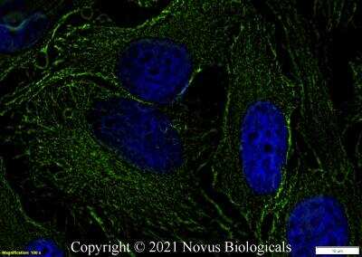 Immunocytochemistry/ Immunofluorescence: alpha Tubulin Antibody (YL1/2) - BSA Free [NB600-506]